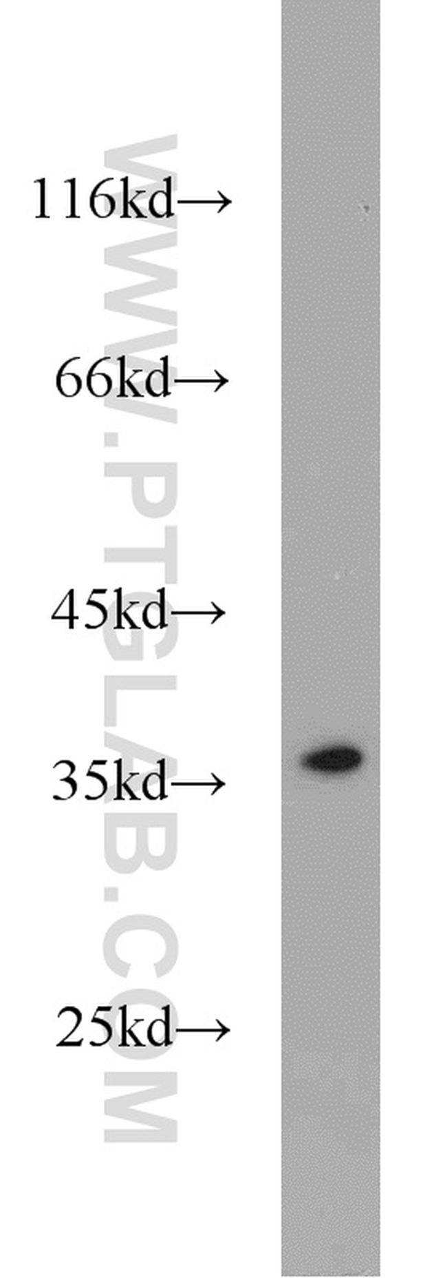 TTF1/NKX2-1 Antibody in Western Blot (WB)