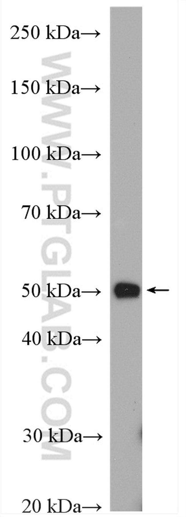 TTF1/NKX2-1 Antibody in Western Blot (WB)