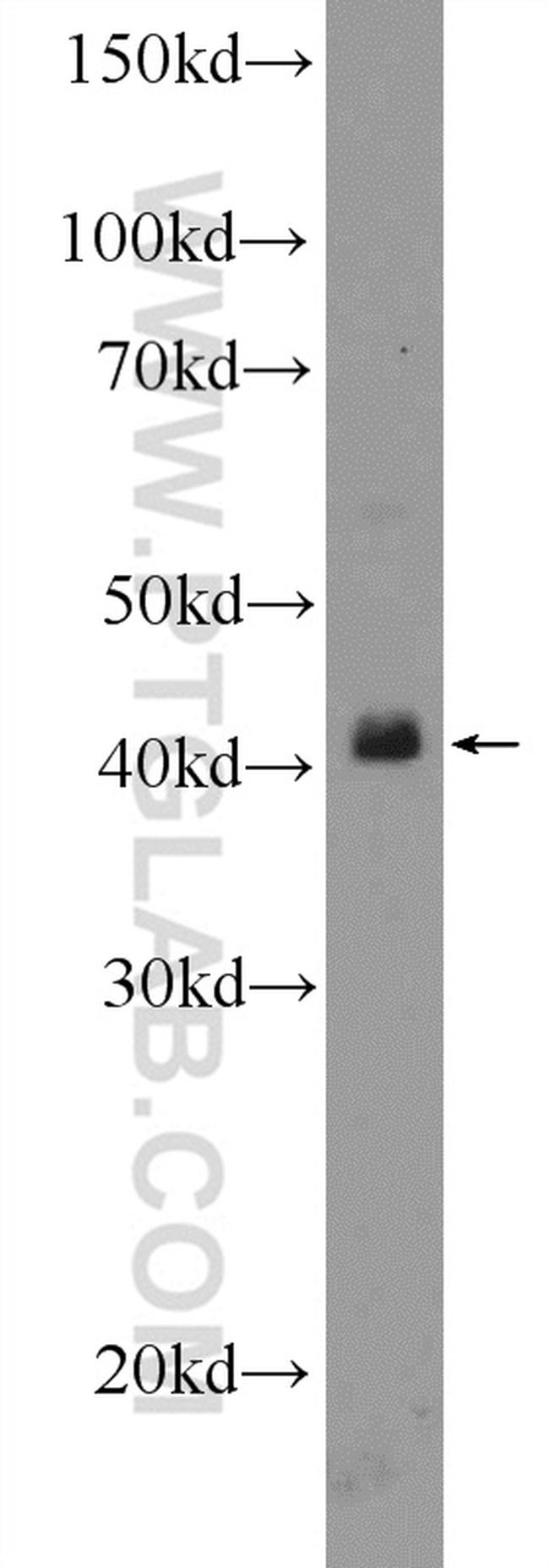 TTF1/NKX2-1 Antibody in Western Blot (WB)