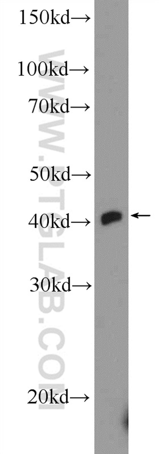 TTF1/NKX2-1 Antibody in Western Blot (WB)