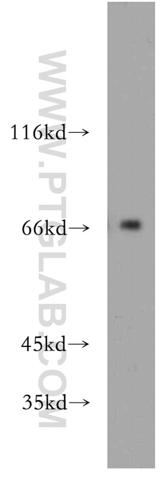 POLA2 Antibody in Western Blot (WB)
