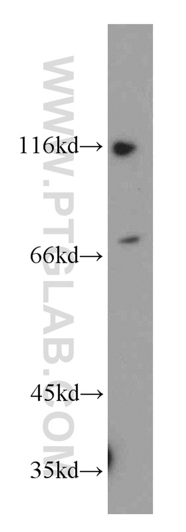 POLA2 Antibody in Western Blot (WB)