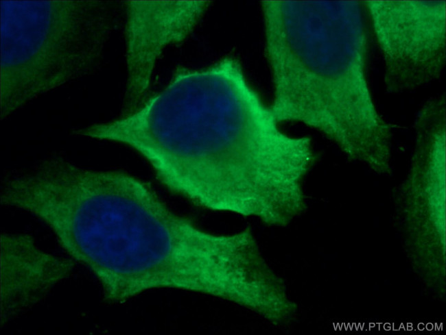 LDHA Antibody in Immunocytochemistry (ICC/IF)