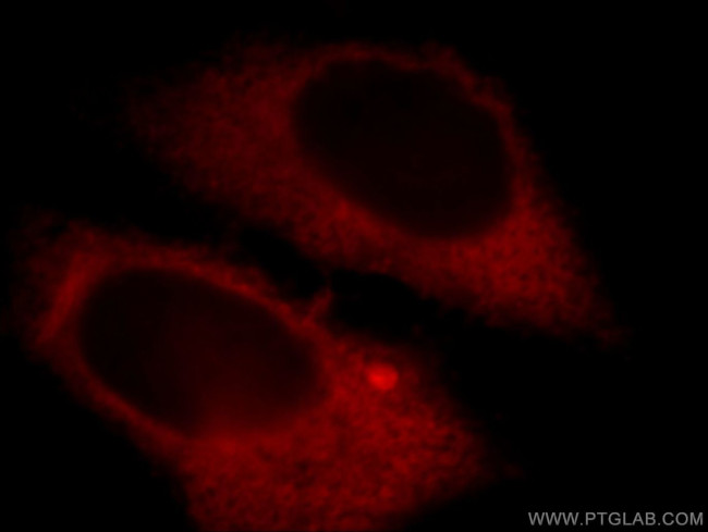 LDHA Antibody in Immunocytochemistry (ICC/IF)