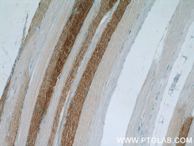 LDHA Antibody in Immunohistochemistry (Paraffin) (IHC (P))