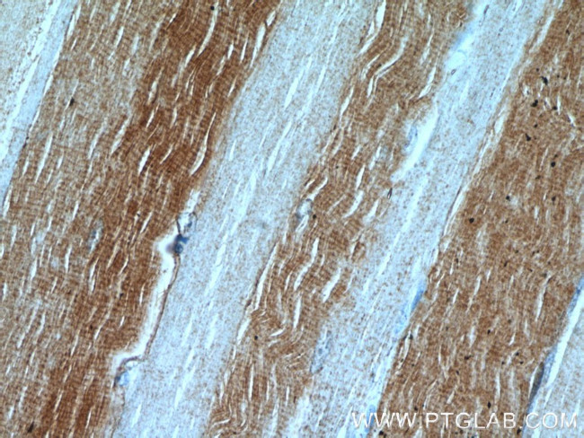 LDHA Antibody in Immunohistochemistry (Paraffin) (IHC (P))