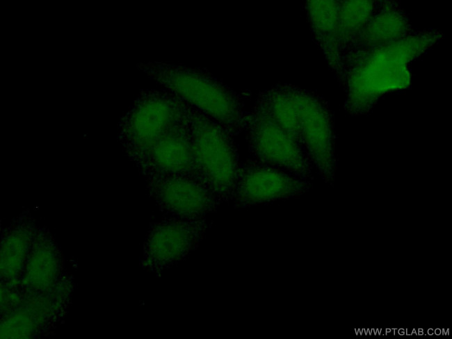 EZH2 Antibody in Immunocytochemistry (ICC/IF)