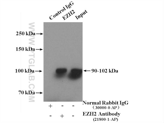 EZH2 Antibody in Immunoprecipitation (IP)