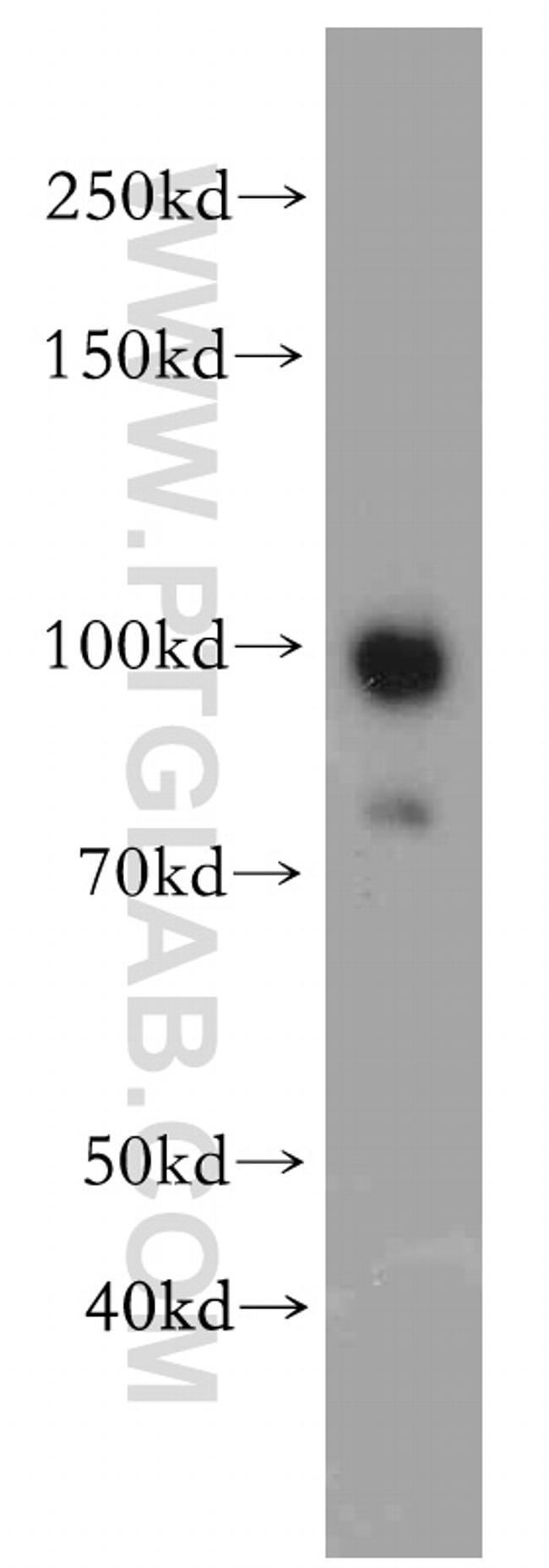 EZH2 Antibody in Western Blot (WB)