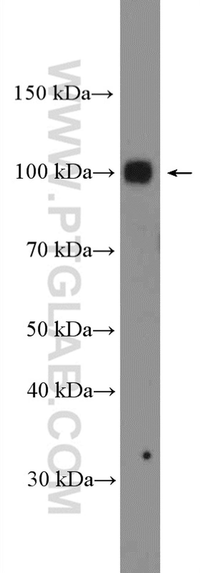 EZH2 Antibody in Western Blot (WB)