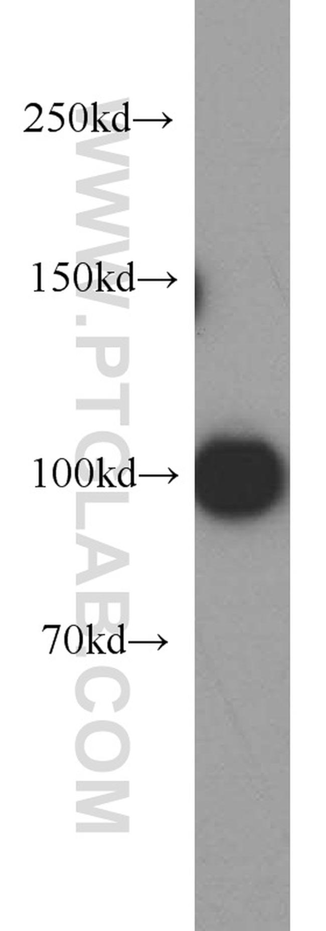 EZH2 Antibody in Western Blot (WB)