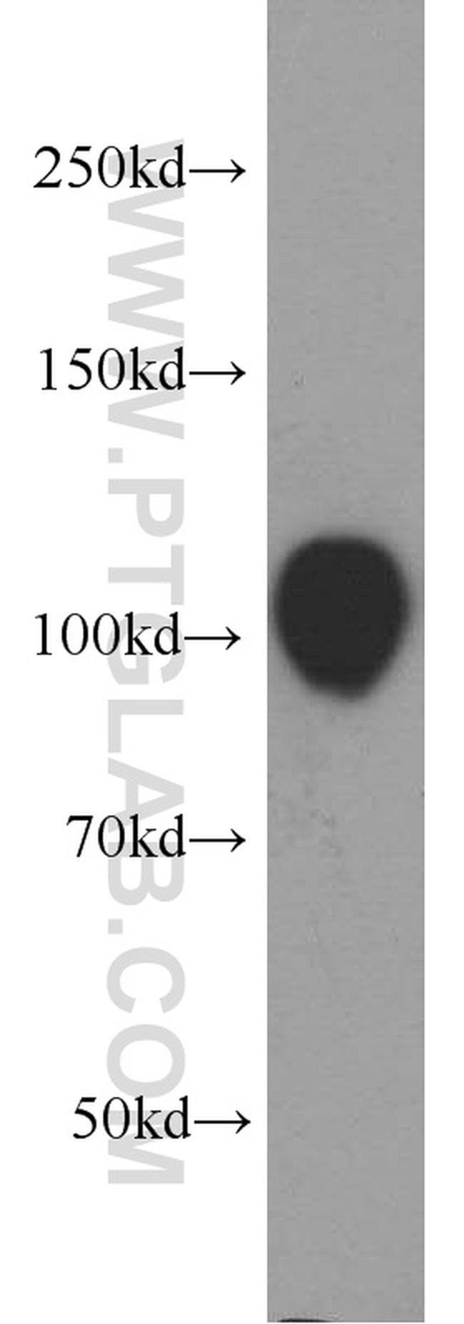 EZH2 Antibody in Western Blot (WB)