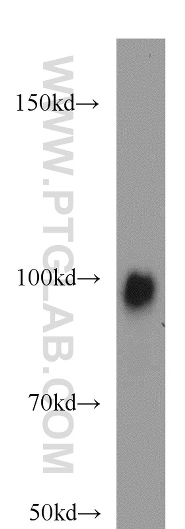 EZH2 Antibody in Western Blot (WB)