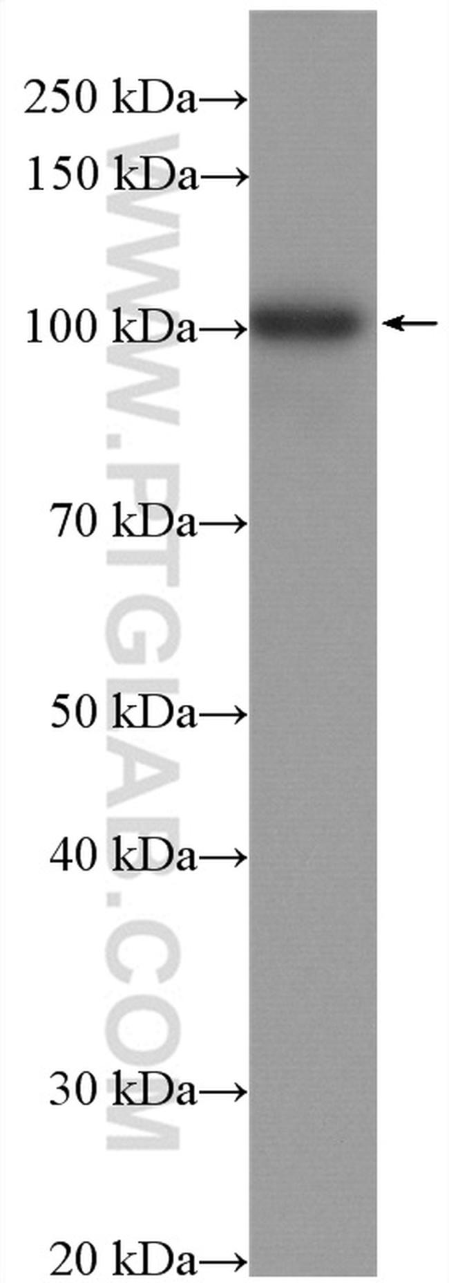 EZH2 Antibody in Western Blot (WB)