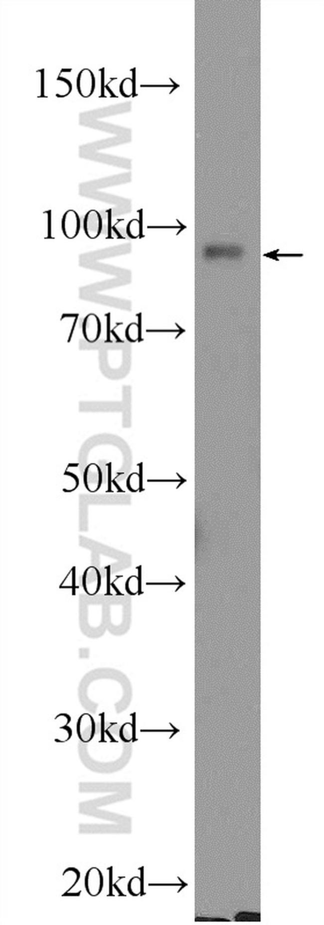 EZH2 Antibody in Western Blot (WB)