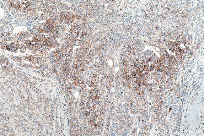 GLUT1 Antibody in Immunohistochemistry (Paraffin) (IHC (P))