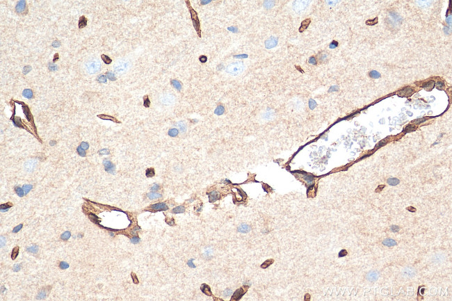 GLUT1 Antibody in Immunohistochemistry (Paraffin) (IHC (P))