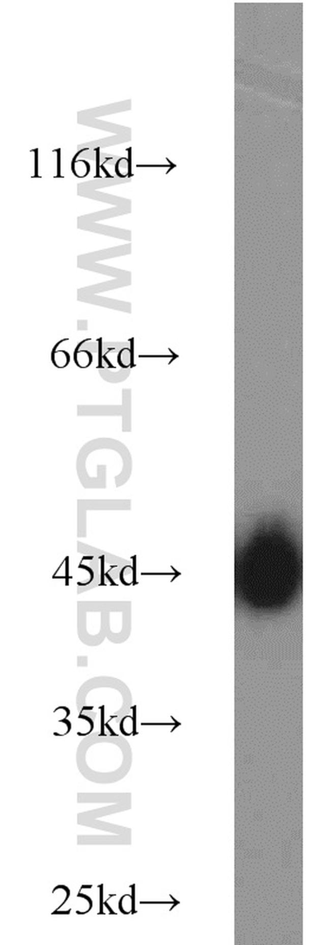 GLUT1 Antibody in Western Blot (WB)