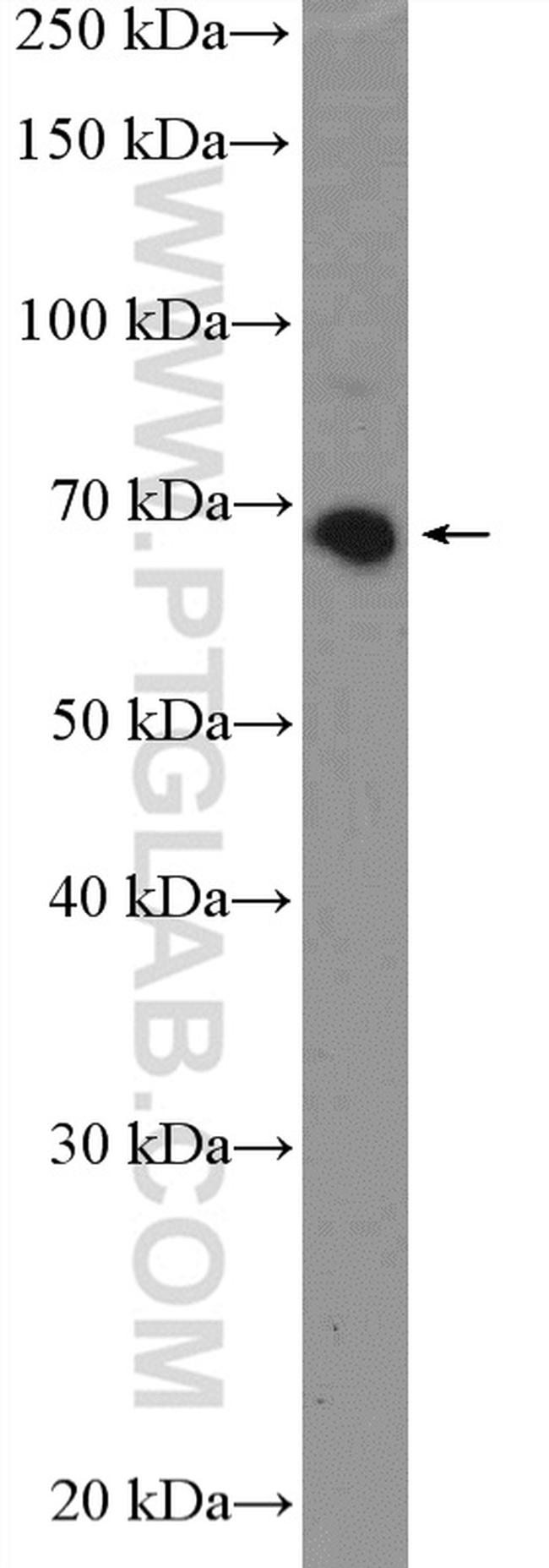 KBTBD5 Antibody in Western Blot (WB)