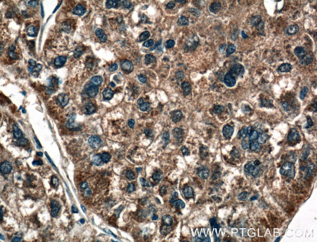 MASP1 Antibody in Immunohistochemistry (Paraffin) (IHC (P))