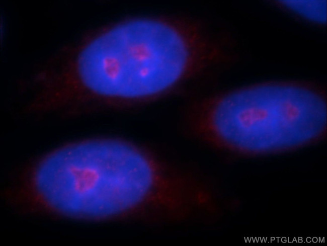 ZNF74 Antibody in Immunocytochemistry (ICC/IF)