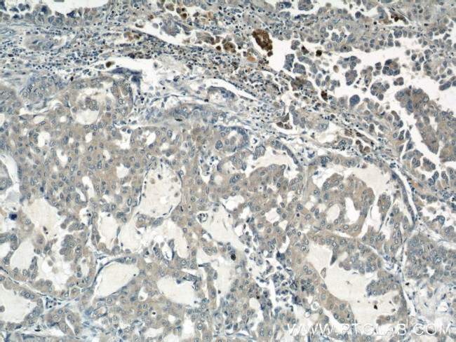 ROCK1 Antibody in Immunohistochemistry (Paraffin) (IHC (P))