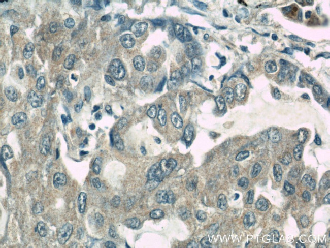 ROCK1 Antibody in Immunohistochemistry (Paraffin) (IHC (P))