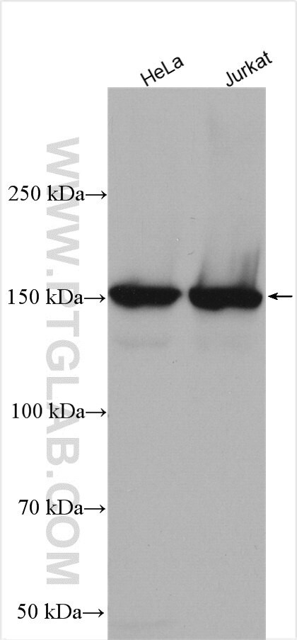 ROCK1 Antibody in Western Blot (WB)