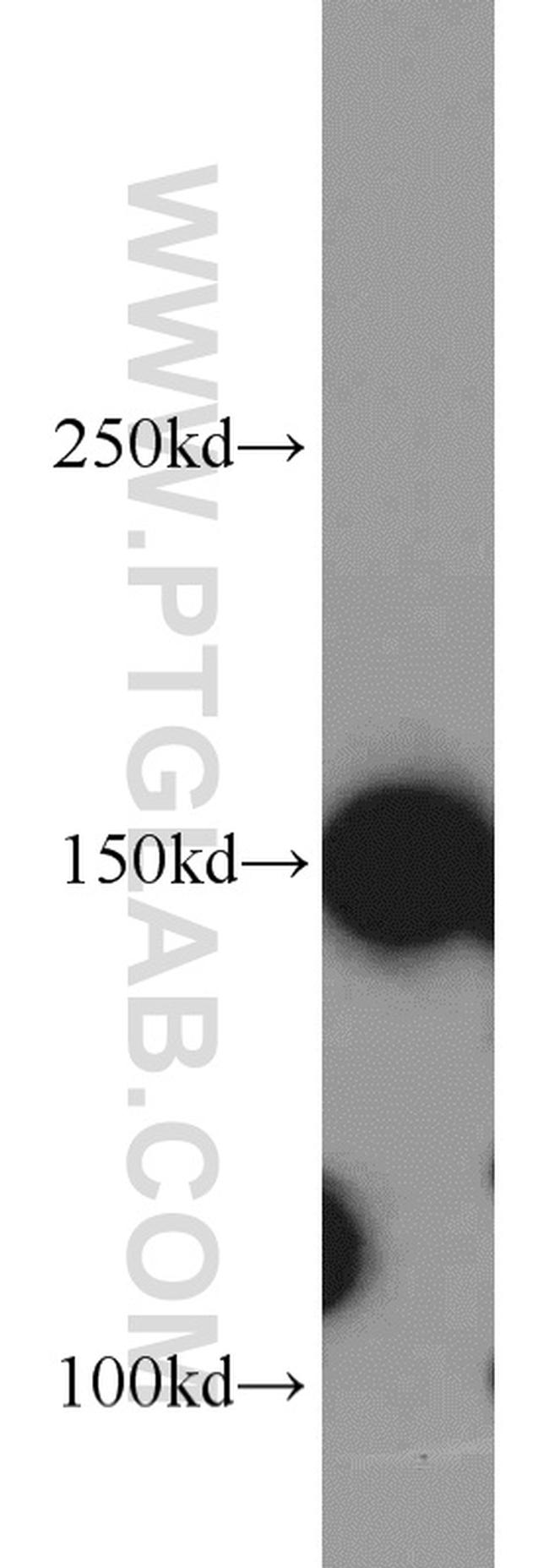 ROCK1 Antibody in Western Blot (WB)