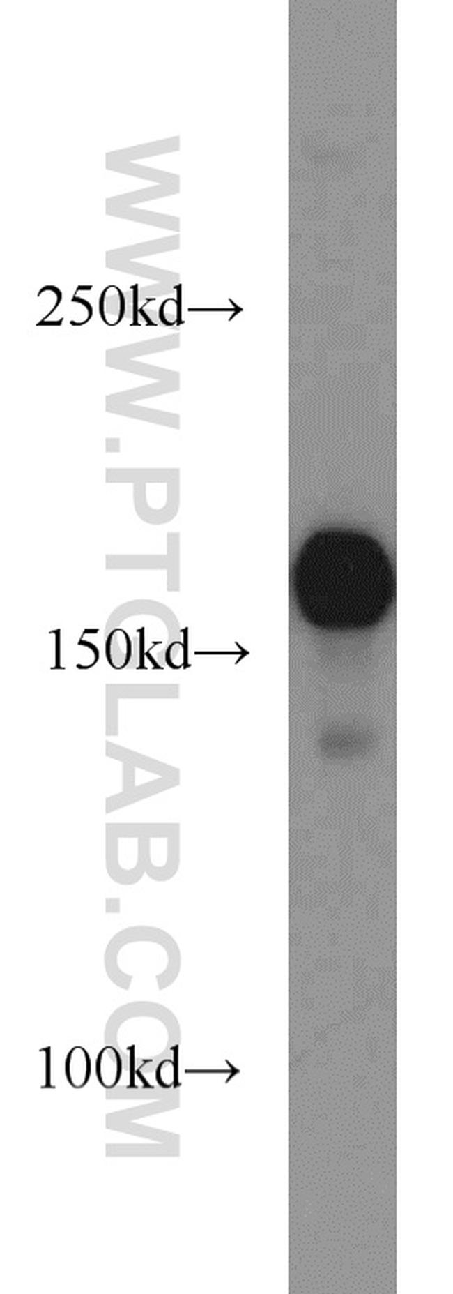 ROCK1 Antibody in Western Blot (WB)