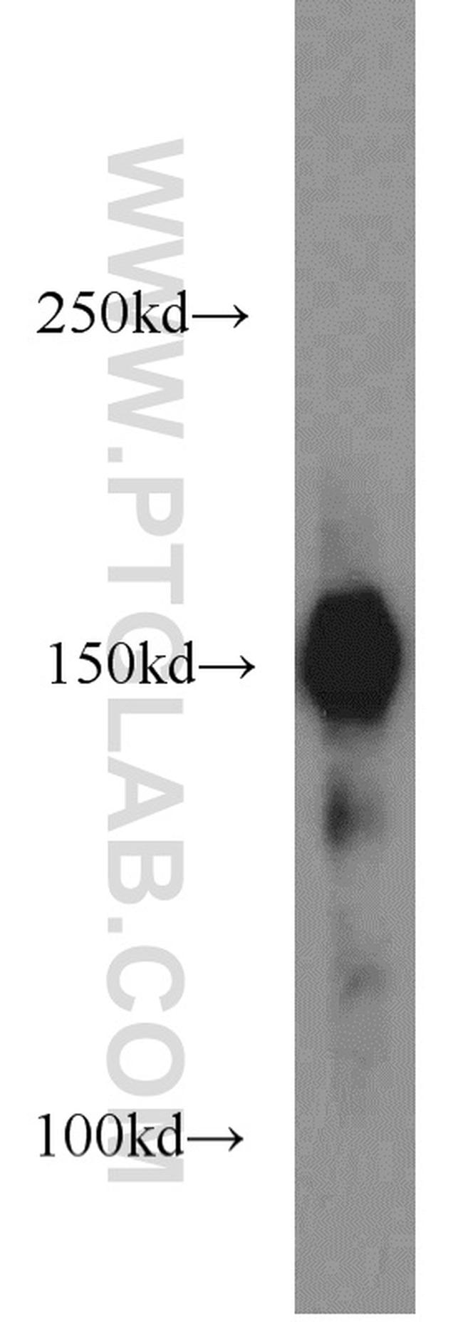 ROCK1 Antibody in Western Blot (WB)