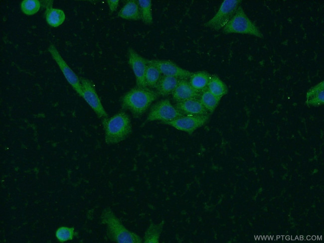 SOAT2 Antibody in Immunocytochemistry (ICC/IF)