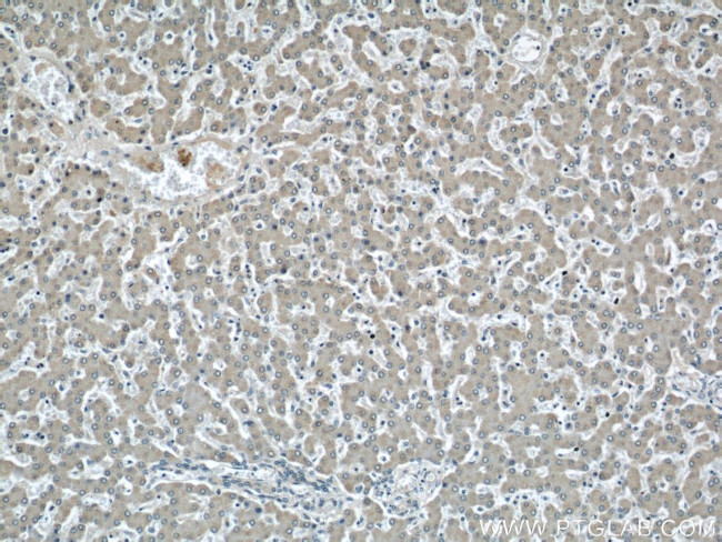 SOAT2 Antibody in Immunohistochemistry (Paraffin) (IHC (P))