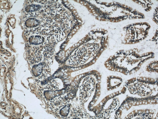 SOAT2 Antibody in Immunohistochemistry (Paraffin) (IHC (P))