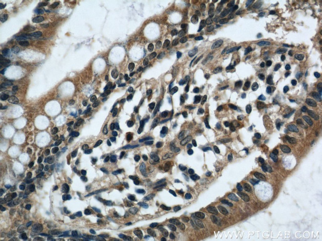 SOAT2 Antibody in Immunohistochemistry (Paraffin) (IHC (P))