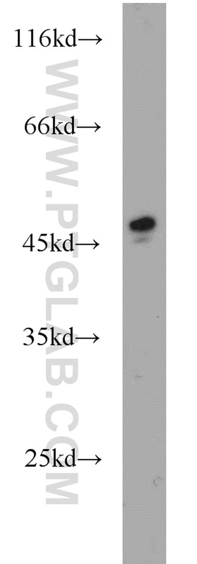 SOAT2 Antibody in Western Blot (WB)