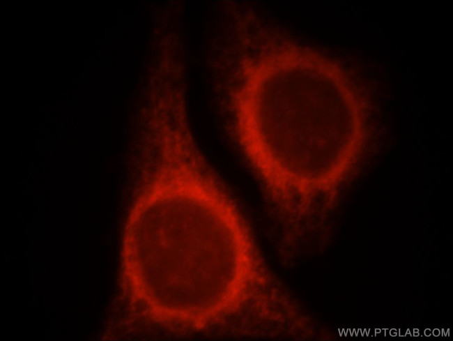 NR3C2 Antibody in Immunocytochemistry (ICC/IF)