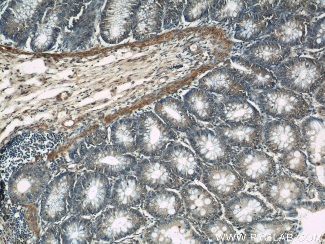 NR3C2 Antibody in Immunohistochemistry (Paraffin) (IHC (P))