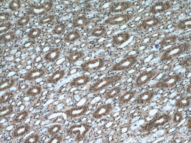 NR3C2 Antibody in Immunohistochemistry (Paraffin) (IHC (P))