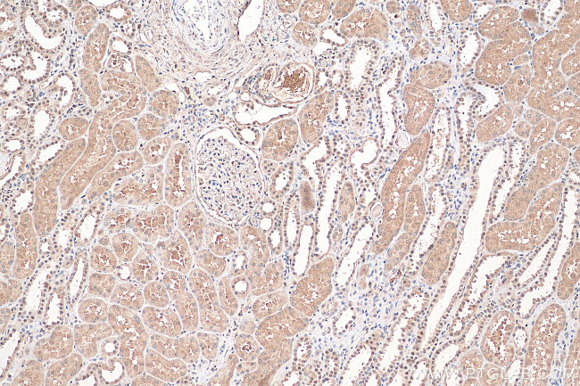 NR3C2 Antibody in Immunohistochemistry (Paraffin) (IHC (P))