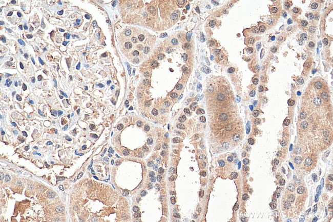 NR3C2 Antibody in Immunohistochemistry (Paraffin) (IHC (P))