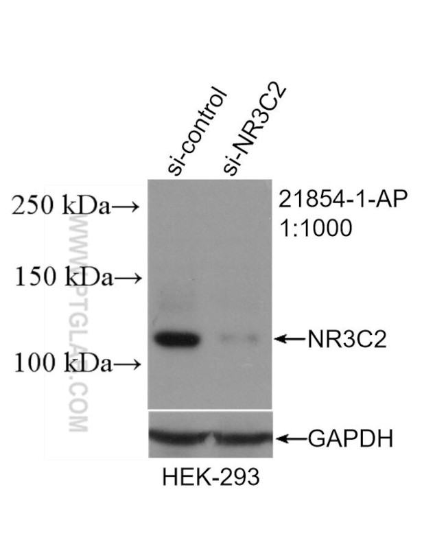 NR3C2 Antibody in Western Blot (WB)