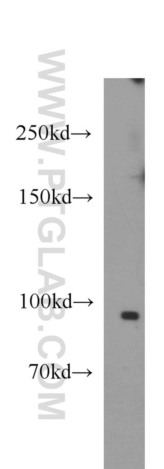 NR3C2 Antibody in Western Blot (WB)