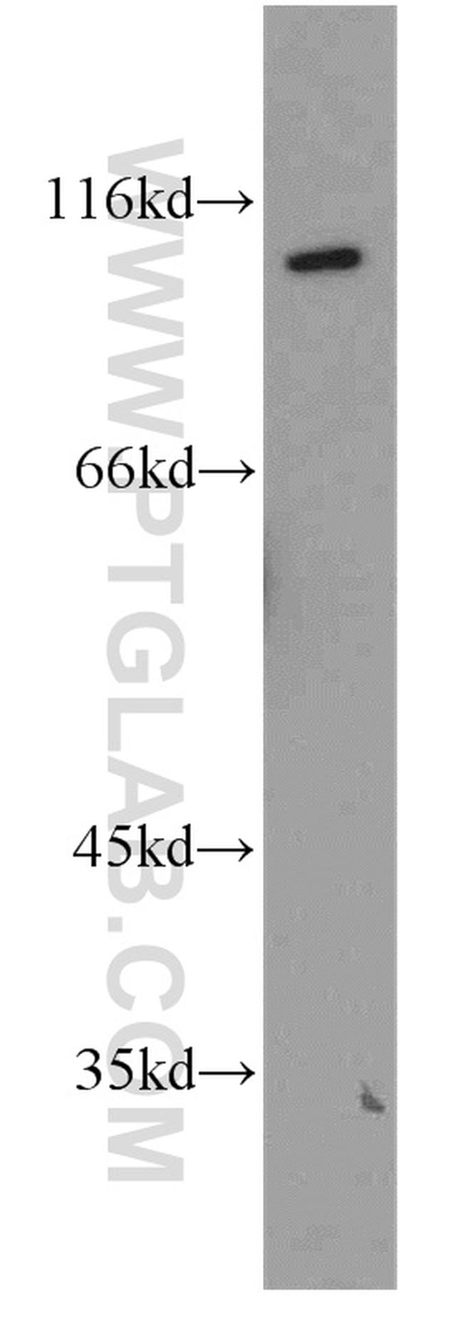 NR3C2 Antibody in Western Blot (WB)