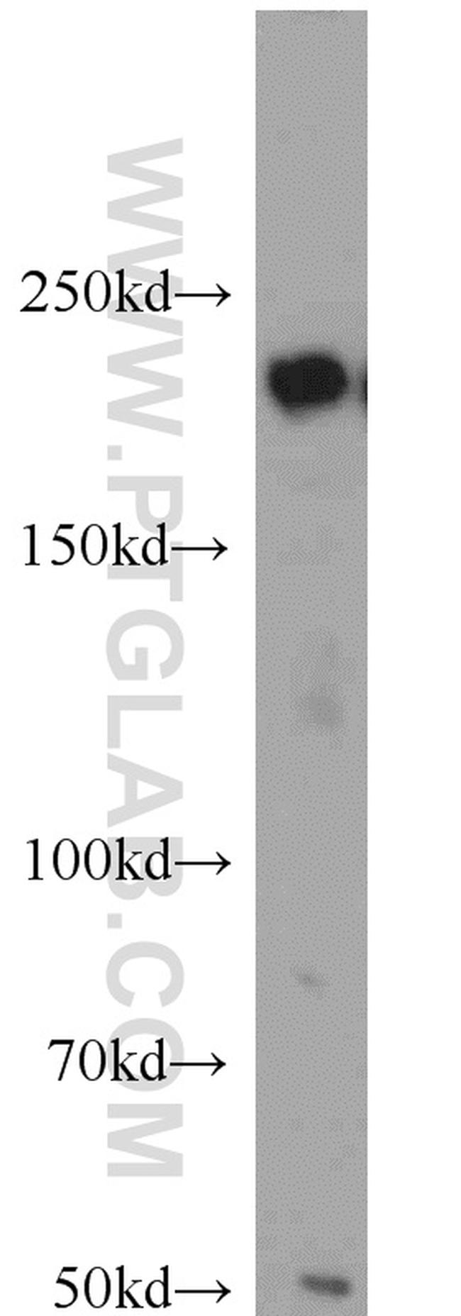 KIDINS220 Antibody in Western Blot (WB)