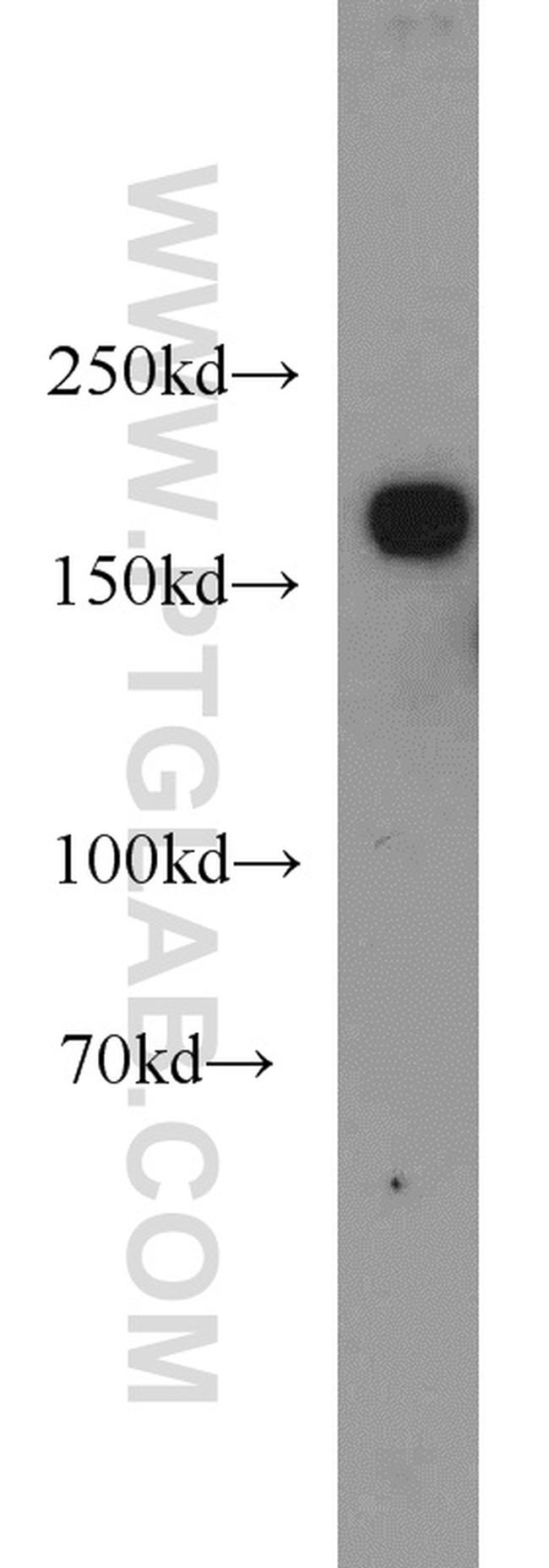 KIDINS220 Antibody in Western Blot (WB)