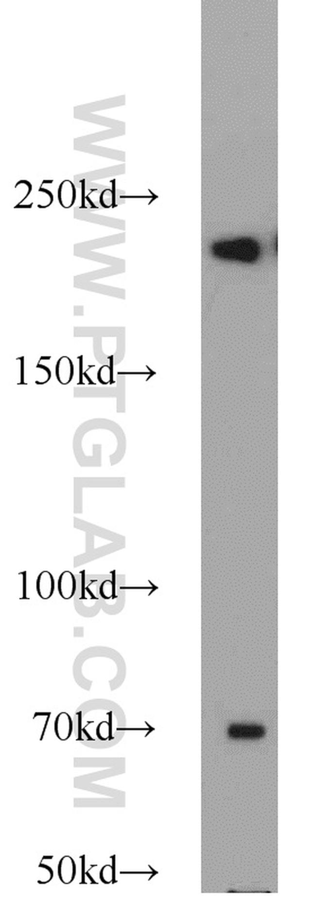 KIDINS220 Antibody in Western Blot (WB)