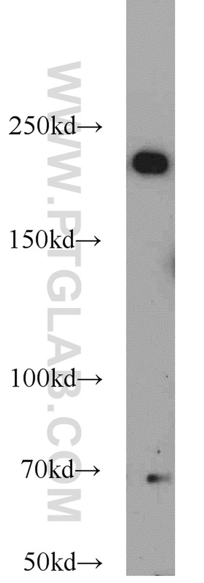 KIDINS220 Antibody in Western Blot (WB)