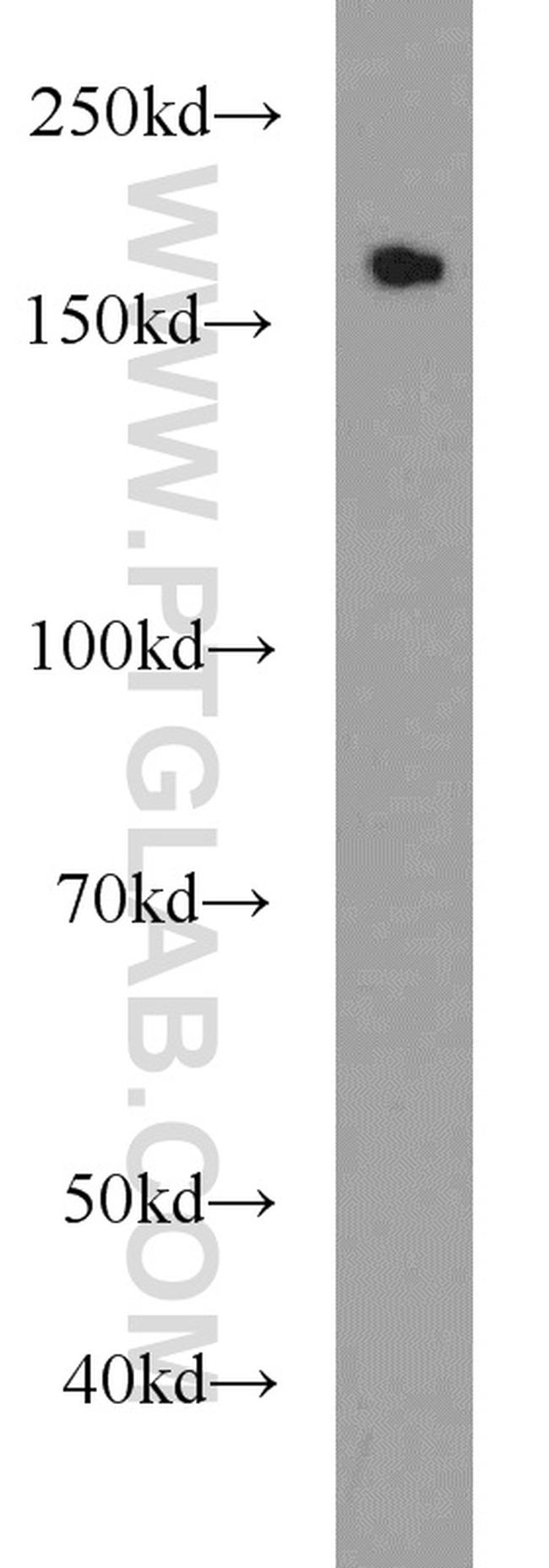 KIDINS220 Antibody in Western Blot (WB)