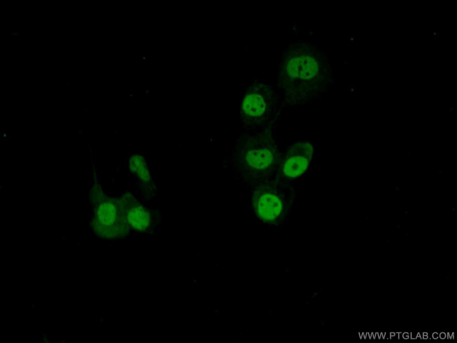 SAFB Antibody in Immunocytochemistry (ICC/IF)